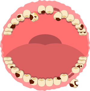 むし歯でボロボロの飾り罫