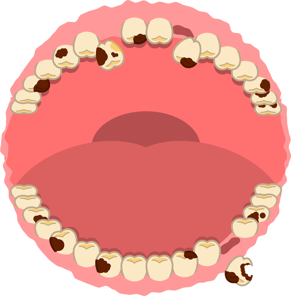 むし歯でボロボロの飾り罫